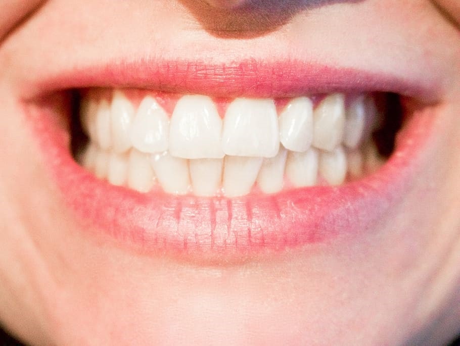 Calculul pe care trebuie sa-l faci atunci cand te intrebi cat costa un implant dentar